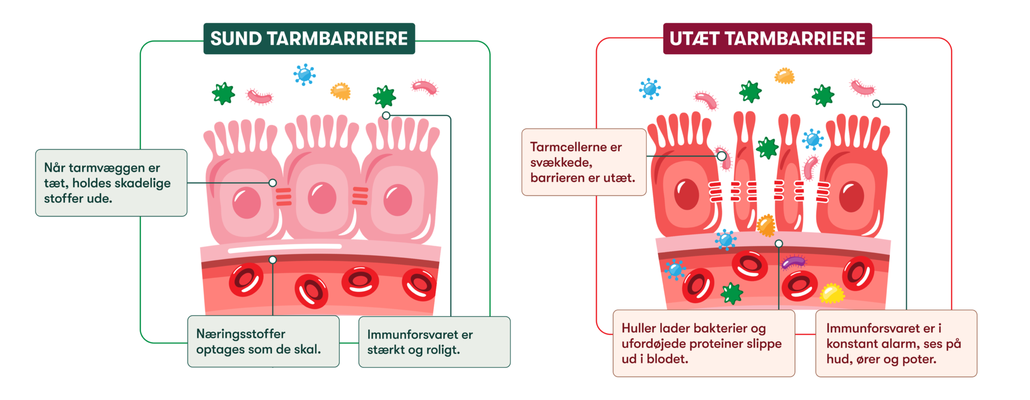 Illustration af sund vs utæt tarmbarriere: tætte tarmceller med ernæringsoptagelse og lækkende tarm med bakterier i blodet